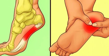 7 effective exercises to reduce heel pain and manage plantar fasciitis naturally